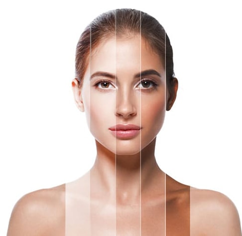 میکرونیدلینگ برای هر رنگ پوستی مناسب است؟ میکرونیدلینگ برای هر رنگ پوستی مناسب است؟